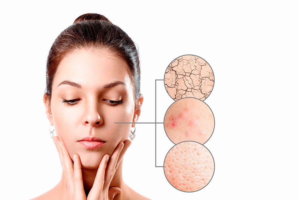 Як піклуватися про суху шкіру обличчя?