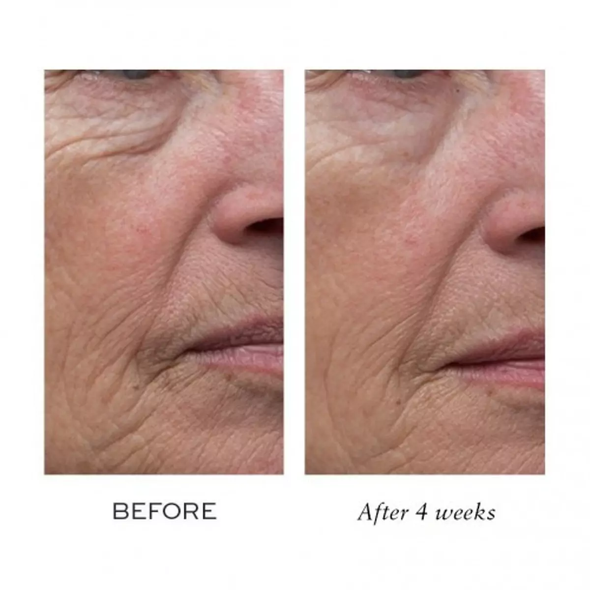 Дневной лифтинг-крем для лица Elemis Pro-Definition Day Cream 