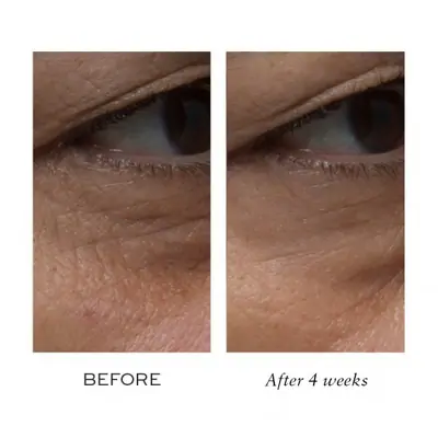 Лифтинг-крем для контурирования зоны вокруг глаз и губ Elemis Pro-Collagen Definition Eye and Lip Contour Cream
