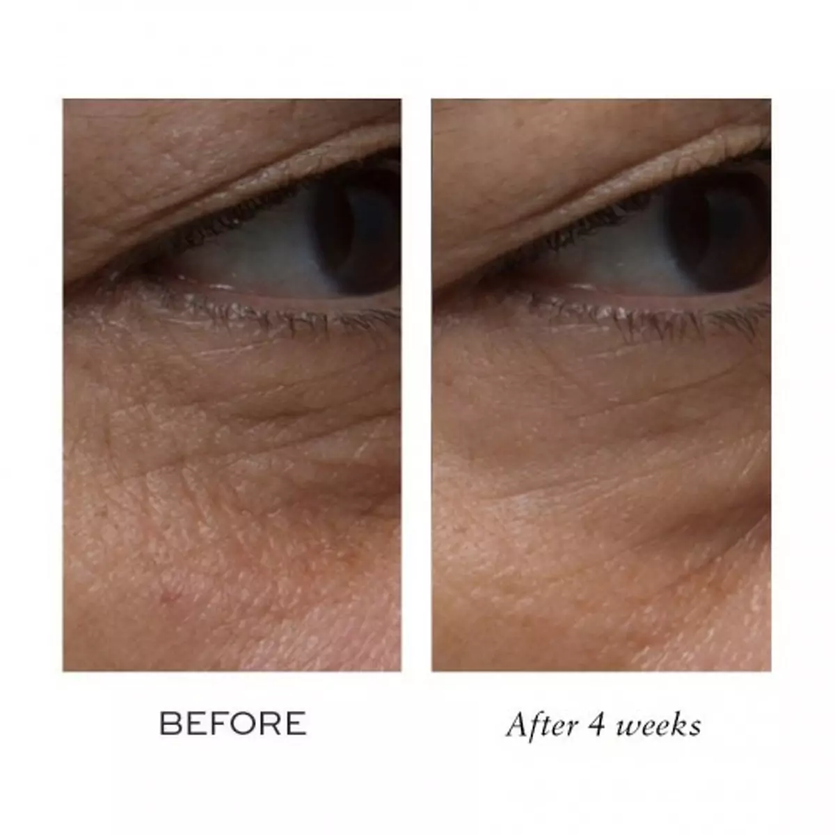 Лифтинг-крем для контурирования зоны вокруг глаз и губ Elemis Pro-Collagen Definition Eye and Lip Contour Cream